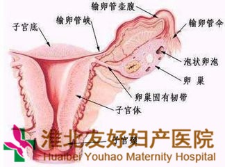 怎樣做好附件炎的預(yù)防保健工作