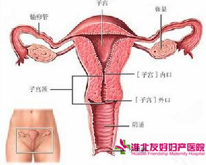 治療附件炎要做哪些檢查