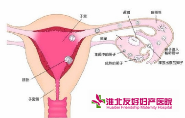 子宮內(nèi)膜炎有哪些早期癥狀