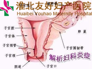 女性如何預(yù)防輸卵管堵塞呢