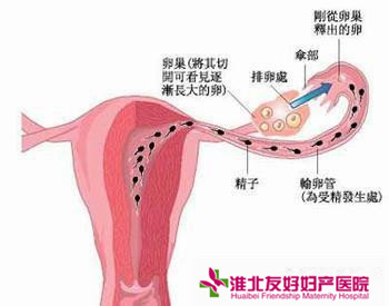 輸卵管不孕有哪些常見癥狀