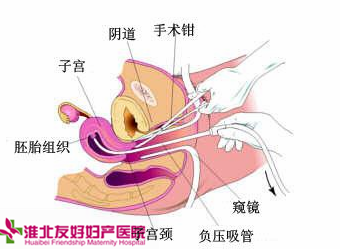 什么原因?qū)е屡悦庖咝圆辉? height=